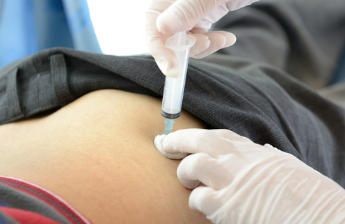 Modelling suggests injectable cabotegravir is far more effective than daily oral PrEP for women