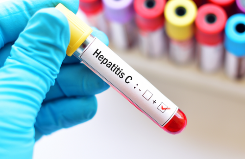 Re-audit of hepatitis care in European HIV services finds improvement in most areas despite challenges